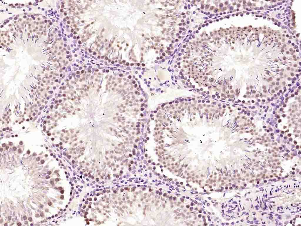 hnRNP K Rabbit pAb(bs-4296R)-5