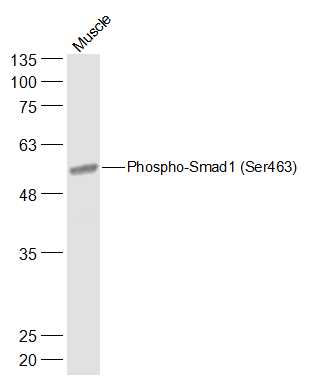 phospho-Smad1 (Ser463) Rabbit 