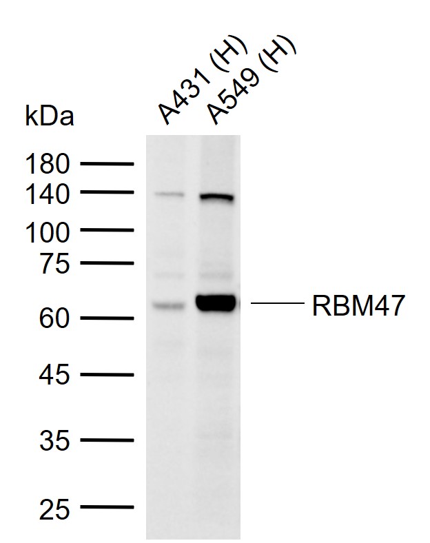 RBM47 Rabbit pAb(bs-19774R)-50
