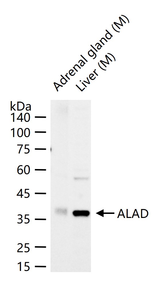 ALAD Rabbit pAb(bs-7954R)-50ul