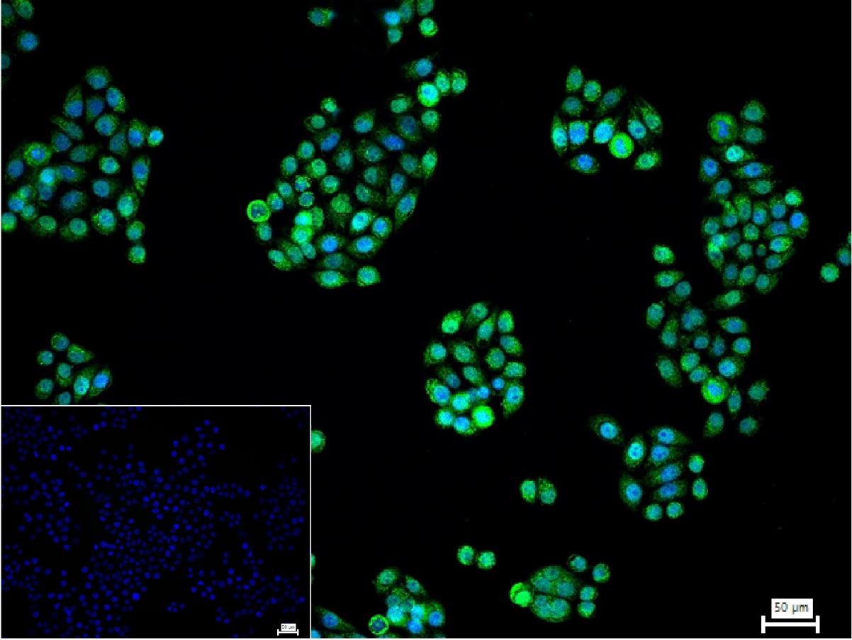 MEPCE Rabbit pAb(bs-18788R)-50