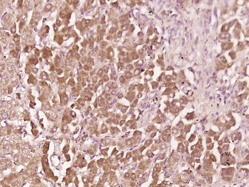 phospho-MCAK (Ser95) Rabbit pA