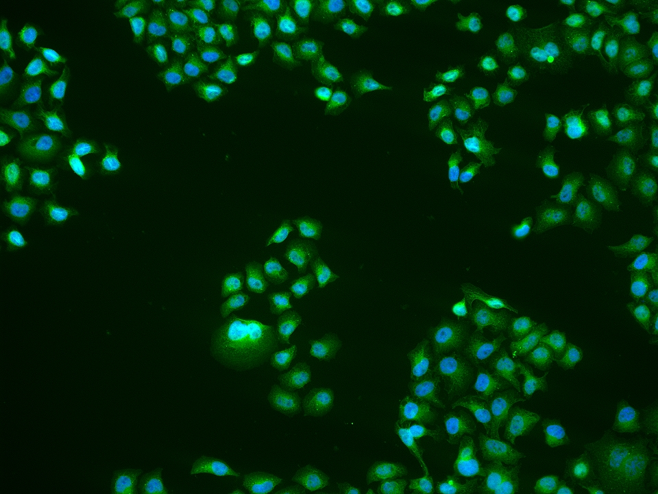 KLF10 Rabbit pAb(bs-1838R)-50u