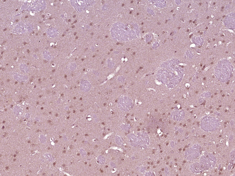 PLASTIN3 Rabbit pAb(bs-3643R)-