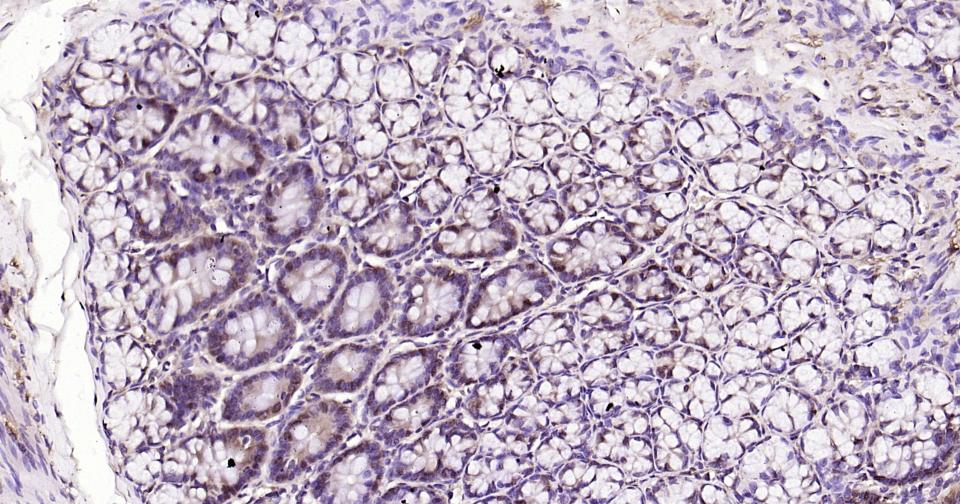 SNAI1 Rabbit pAb(bs-1371R)-50u