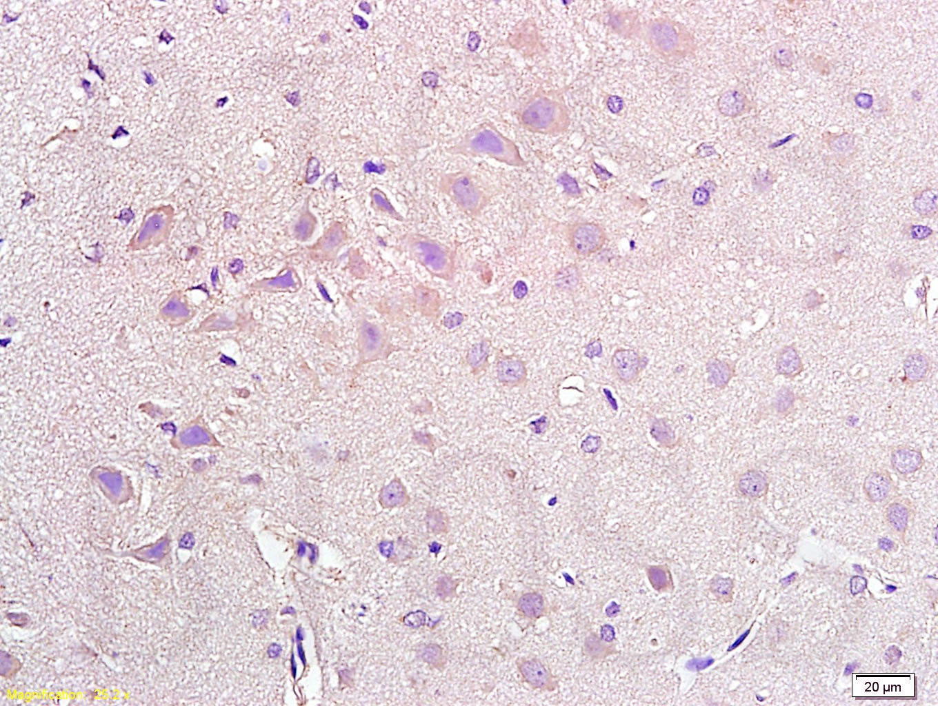 NPY2R Rabbit pAb(bs-0937R)-50u