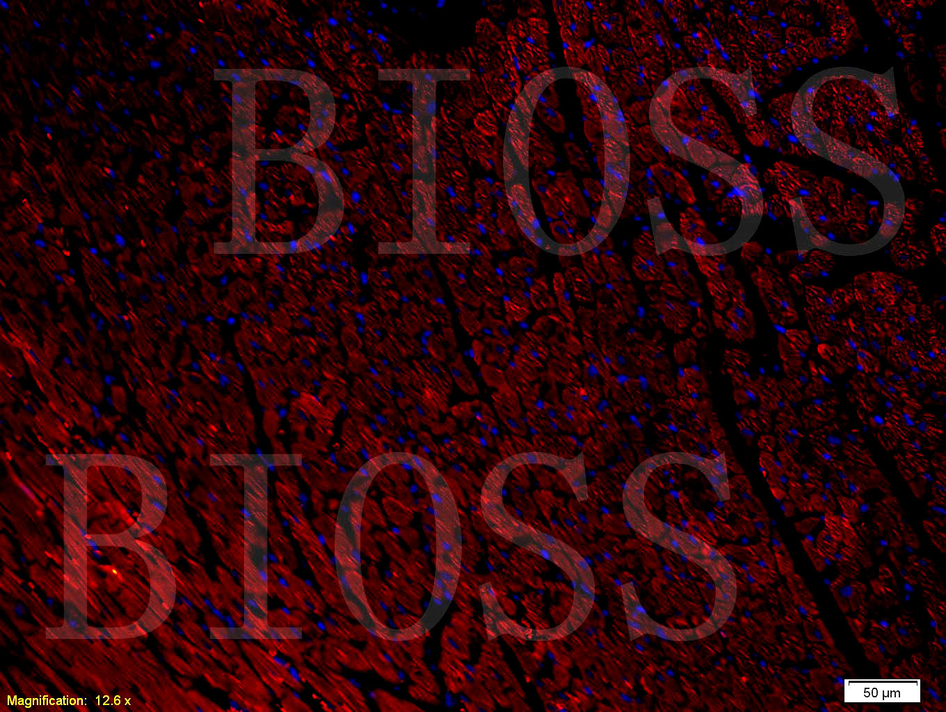 NPY1R Rabbit pAb(bs-1070R)-50u