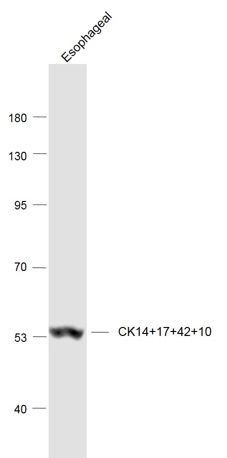 CK14+17+42+10 Rabbit pAb(bs-17