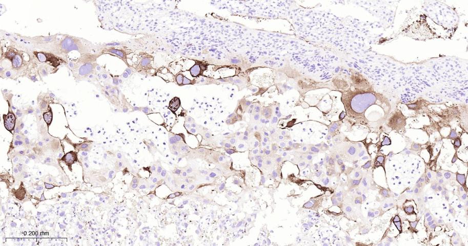 ITGB3 Recombinant Rabbit mAb(b