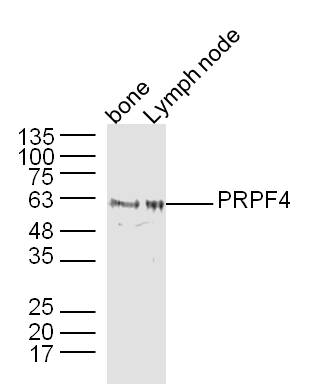 PRPF4 Rabbit pAb(bs-20098R)-50