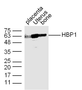 HBP1 Rabbit pAb(bs-15418R)-50u