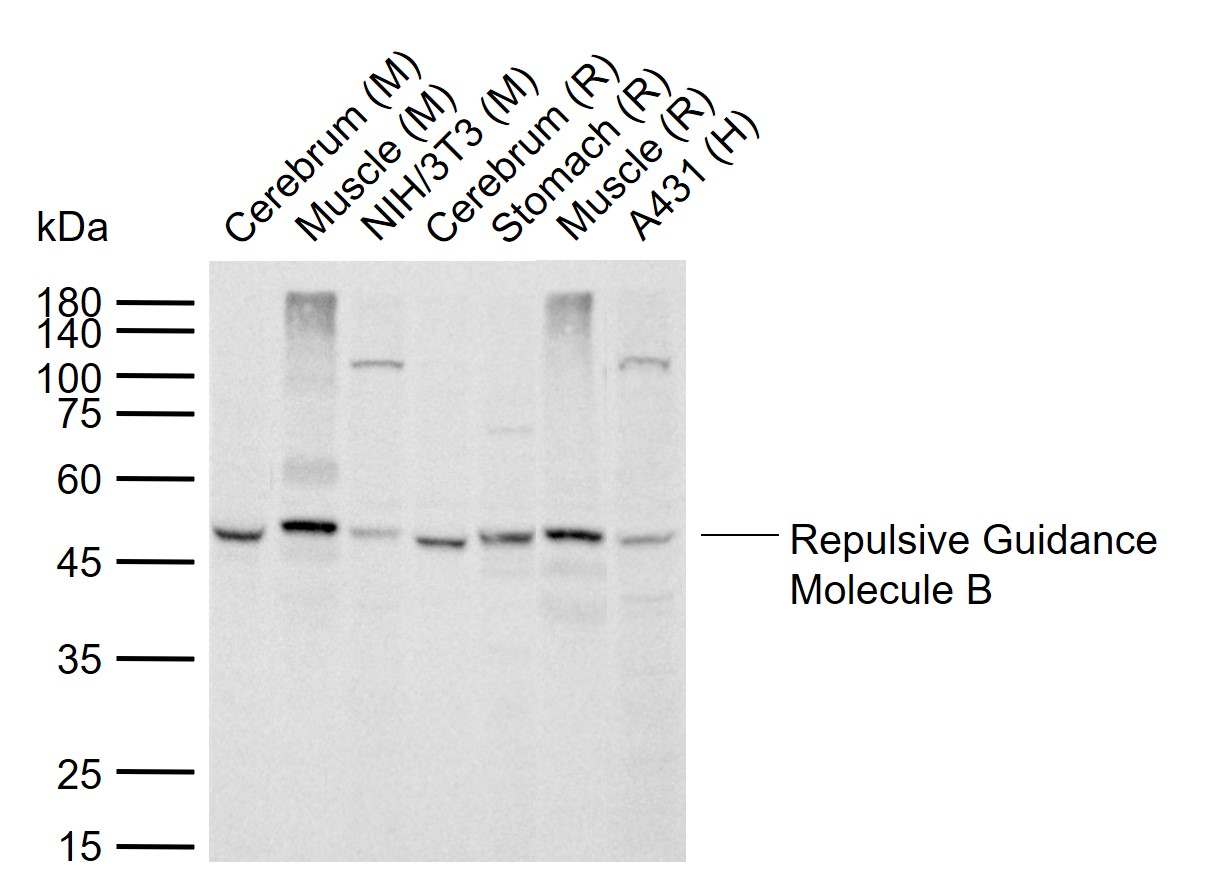 Repulsive Guidance Molecule B