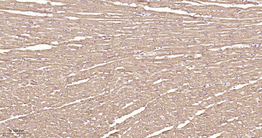 SDHB Recombinant Rabbit mAb(bs