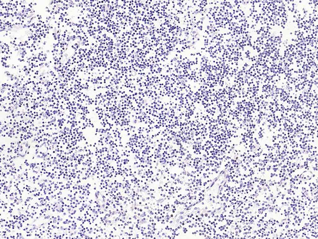 Cytokeratin 8(Ready to use) Mo