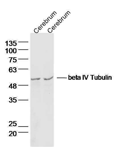 beta IV Tubulin Rabbit pAb(bs-