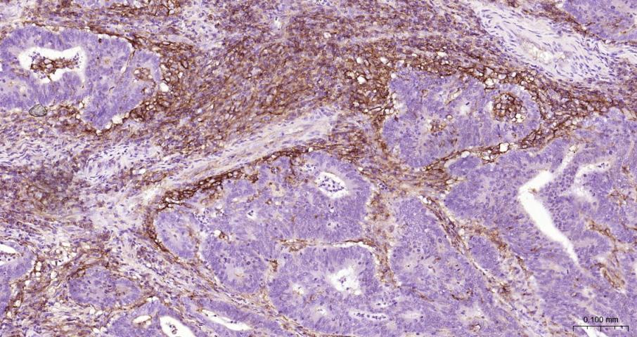 ICAM1 Rabbit pAb(bs-0608R)-50u