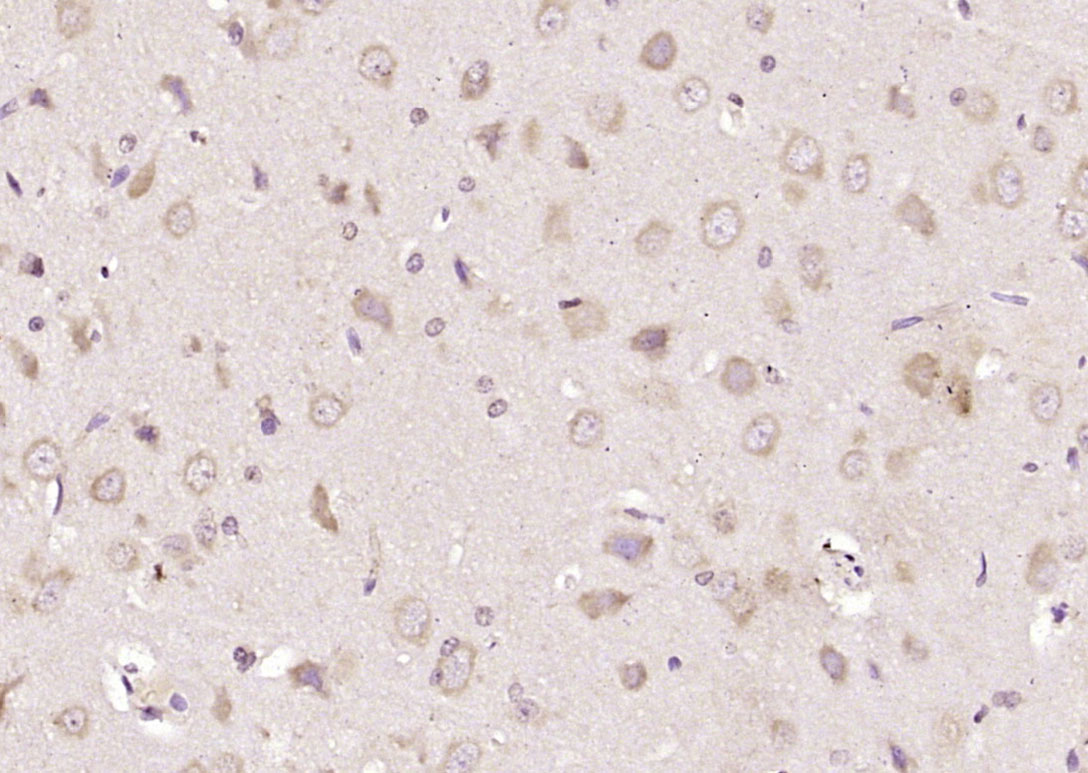 SLC25A1 Rabbit pAb(bs-21219R)-