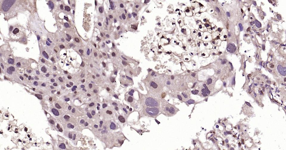 SNAI1 Rabbit pAb(bs-1371R)-50u