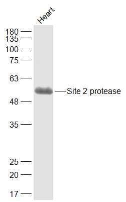 Site 2 protease Rabbit pAb(bs-