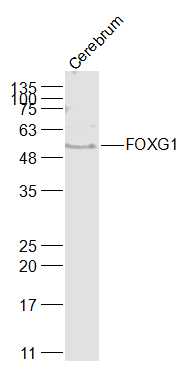 FOXG1 Rabbit pAb(bs-11557R)-50