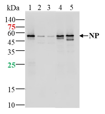 SARS-CoV-2 (2019-nCoV) Nucleoc