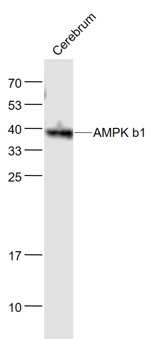 AMPK b1 Mouse mAb(bsm-33426M)-