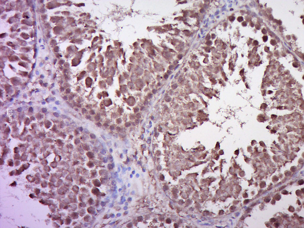 STAT1 Rabbit pAb(bs-1317R)-50u