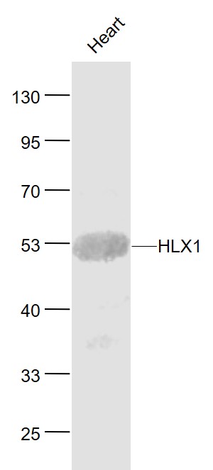HLX1 Rabbit pAb(bs-8174R)-50ul