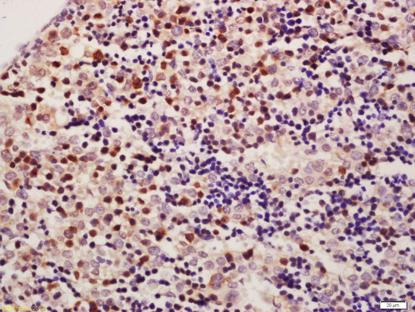 HADHSC Rabbit pAb(bs-10020R)-5