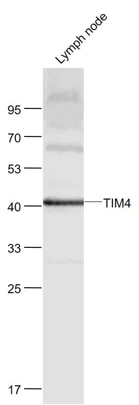 TIM4 Rabbit pAb(bs-6197R)-50ul