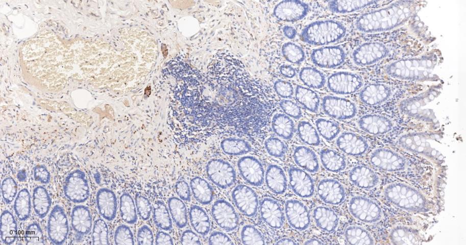 Synaptophysin Recombinant Rabb