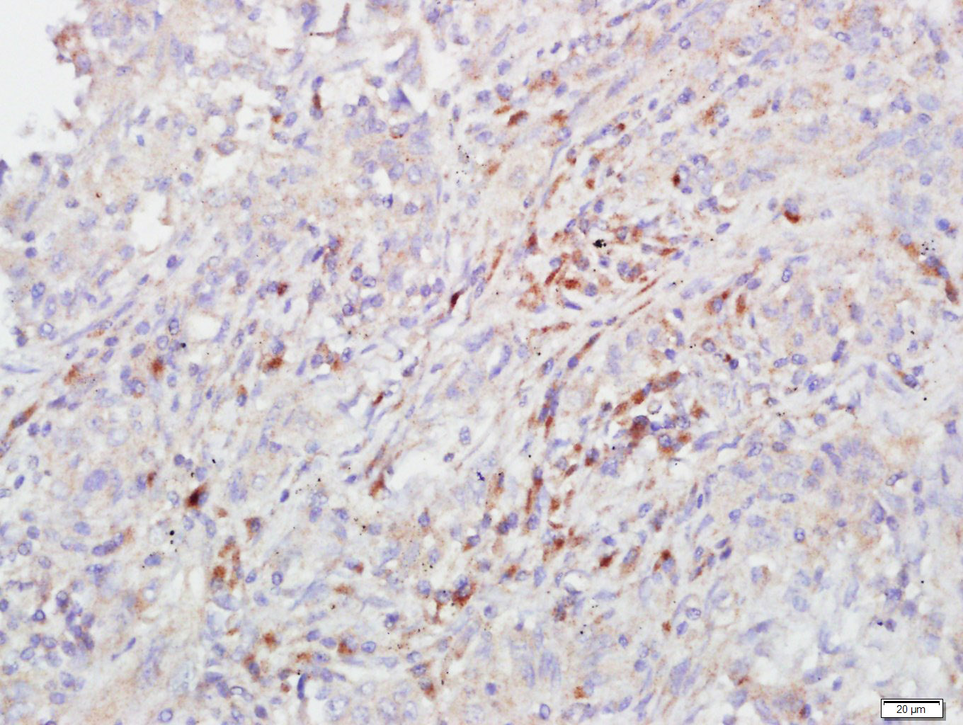 FCAR/CD89 Rabbit pAb(bs-6586R)