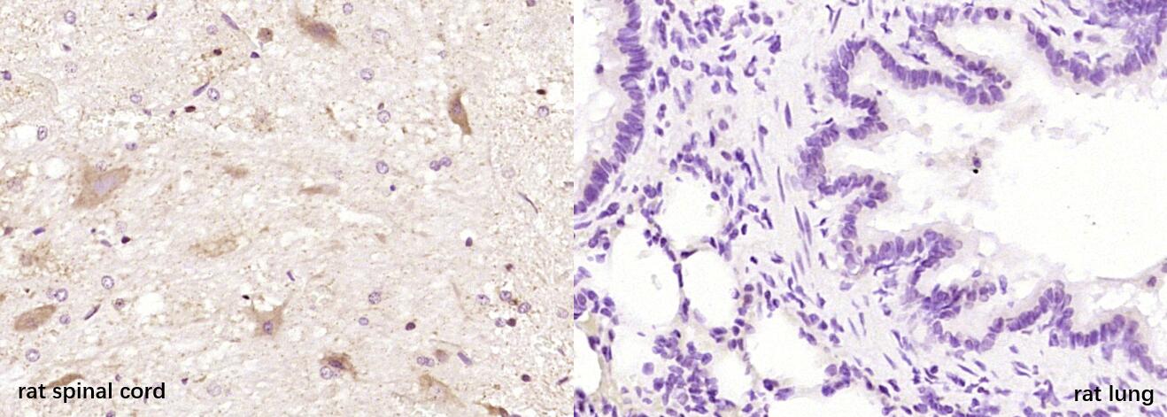 VGLUT2 Rabbit pAb(bs-9686R)-50