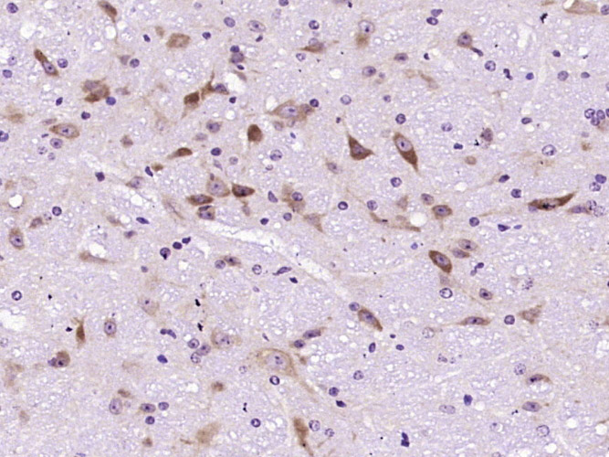 Uricase Rabbit pAb(bs-6716R)-5