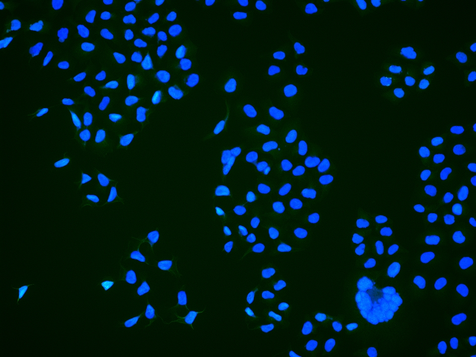 phospho-TOP2A (Ser1106) Rabbit