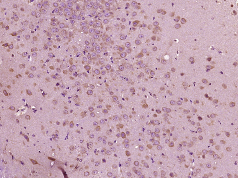 HPCAL4 Rabbit pAb(bs-17377R)-5