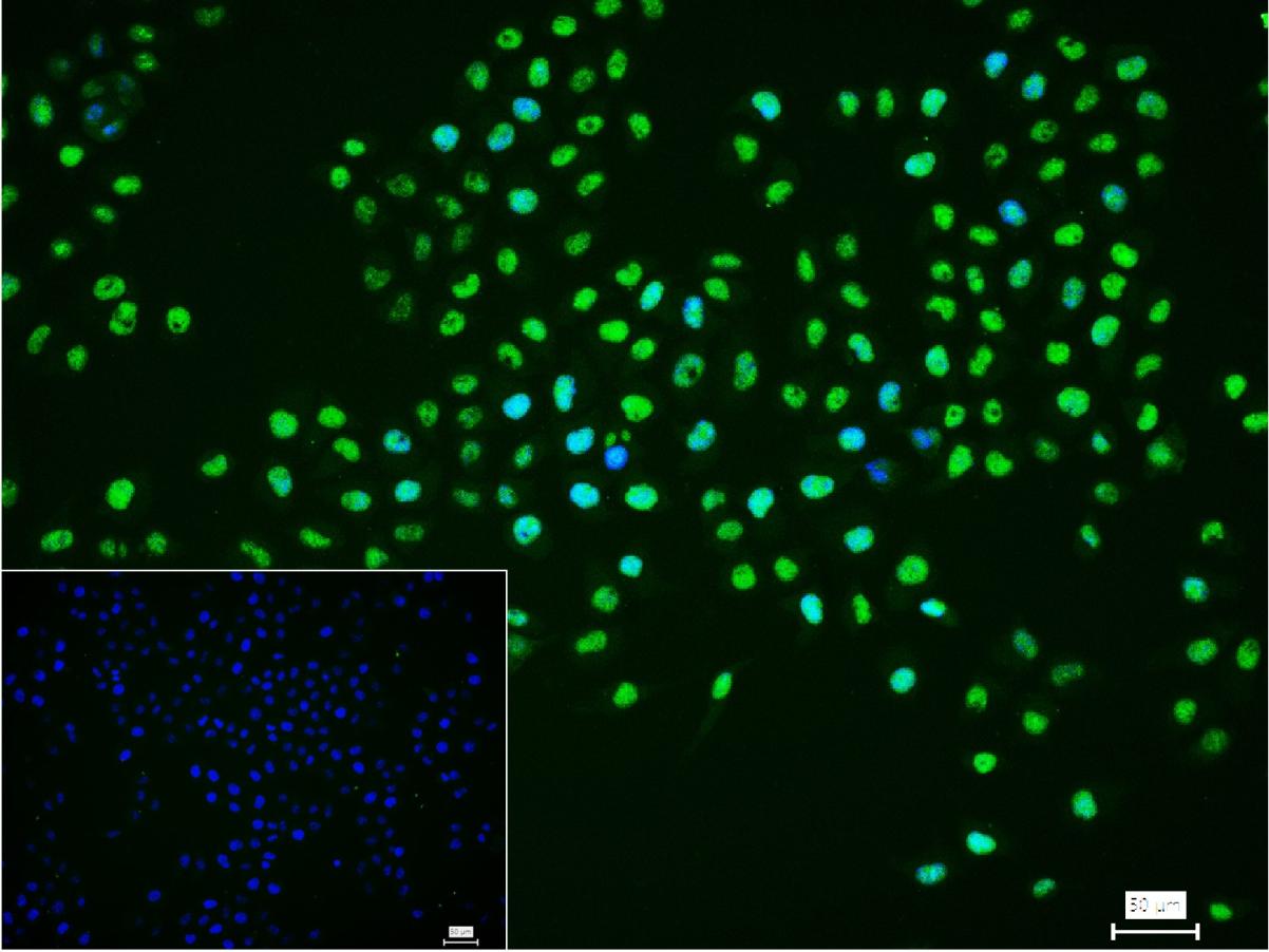 Ku80 Recombinant Rabbit mAb(bs