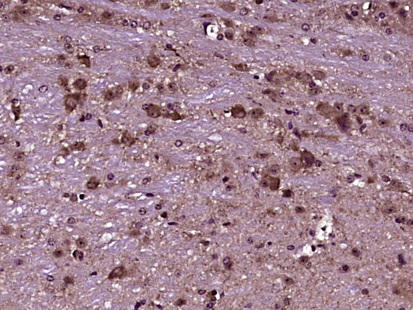 PLXNB3 Rabbit pAb(bs-11470R)-5