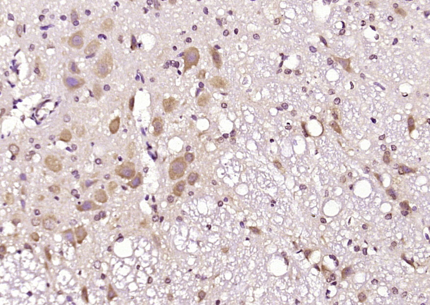 ATG18 Rabbit pAb(bs-3871R)-50u