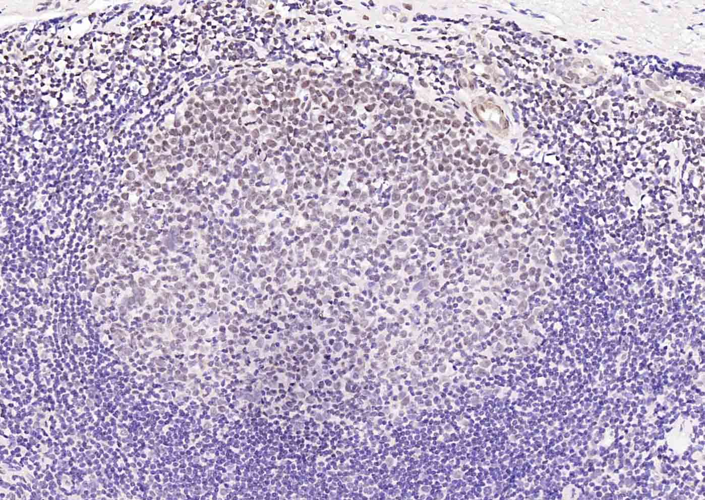 IGF2BP1 Rabbit pAb(bs-8683R)-5