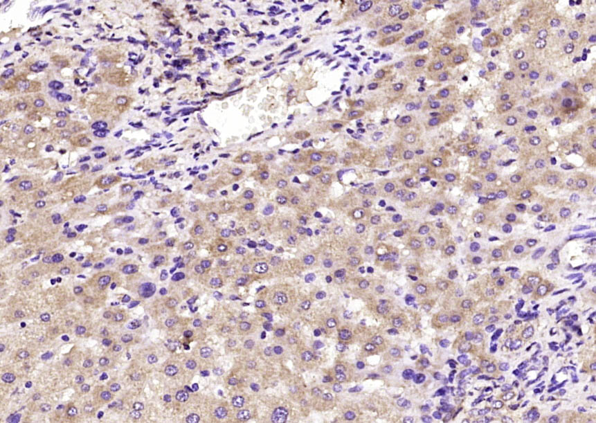 Ceruloplasmin Rabbit pAb(bs-23
