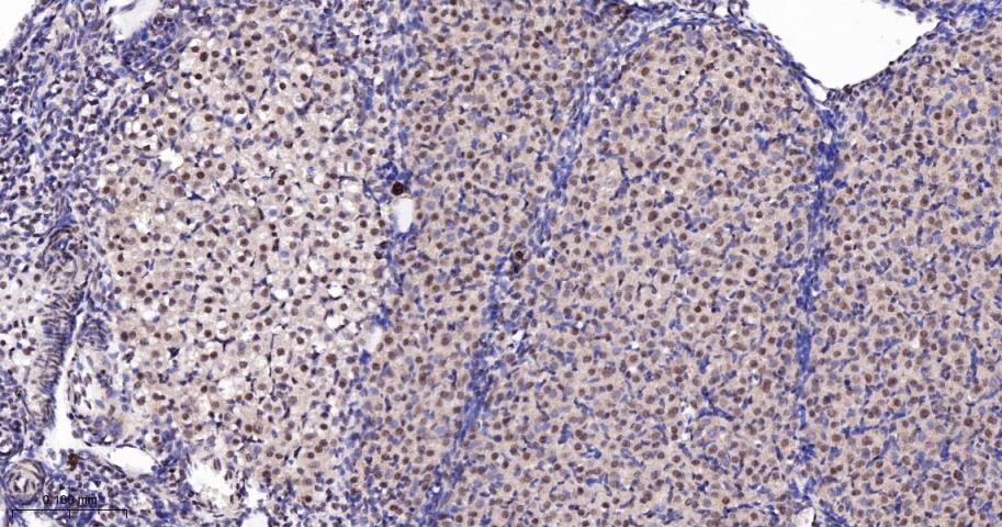 KDM4B Recombinant Rabbit mAb(b