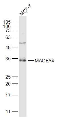 MAGEA4 Rabbit pAb(bs-3645R)-50