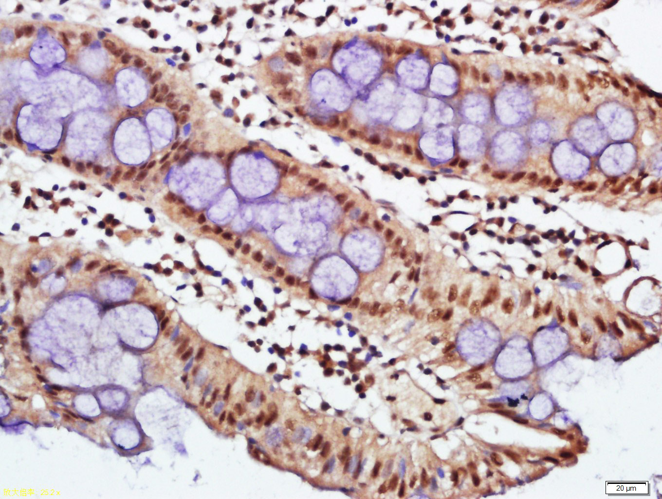 phospho-E2F1 (Ser332) Rabbit p