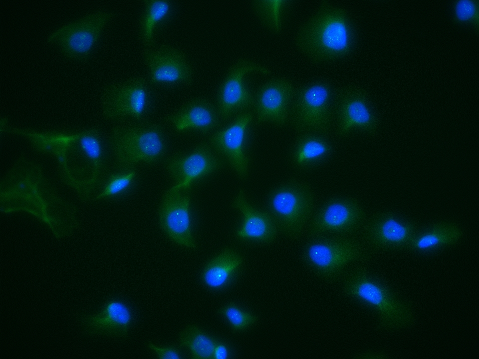 Matriptase Rabbit pAb(bs-0531R