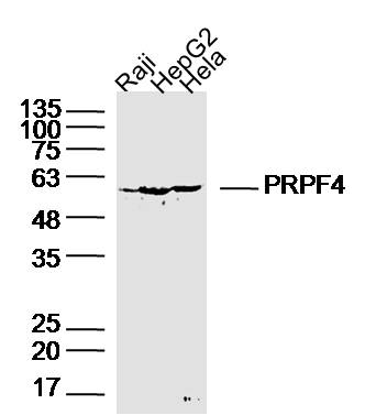 PRPF4 Rabbit pAb(bs-20098R)-50