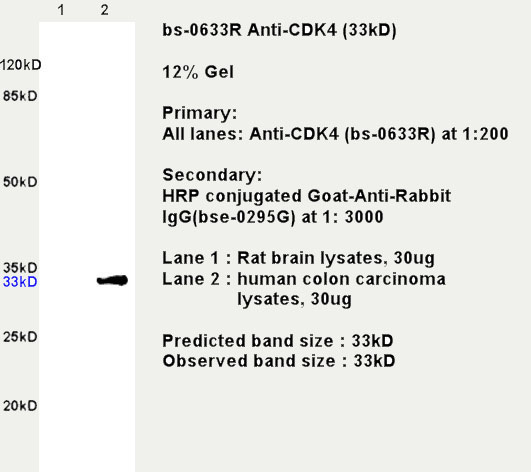 CDK4 Rabbit pAb(bs-0633R)-50ul