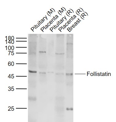 Follistatin Rabbit pAb(bs-1773