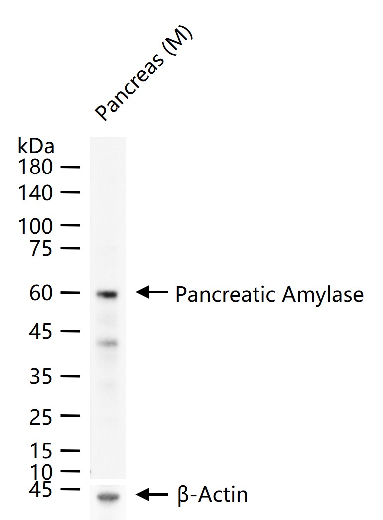 AMY2A Rabbit pAb(bs-3975R)-50u