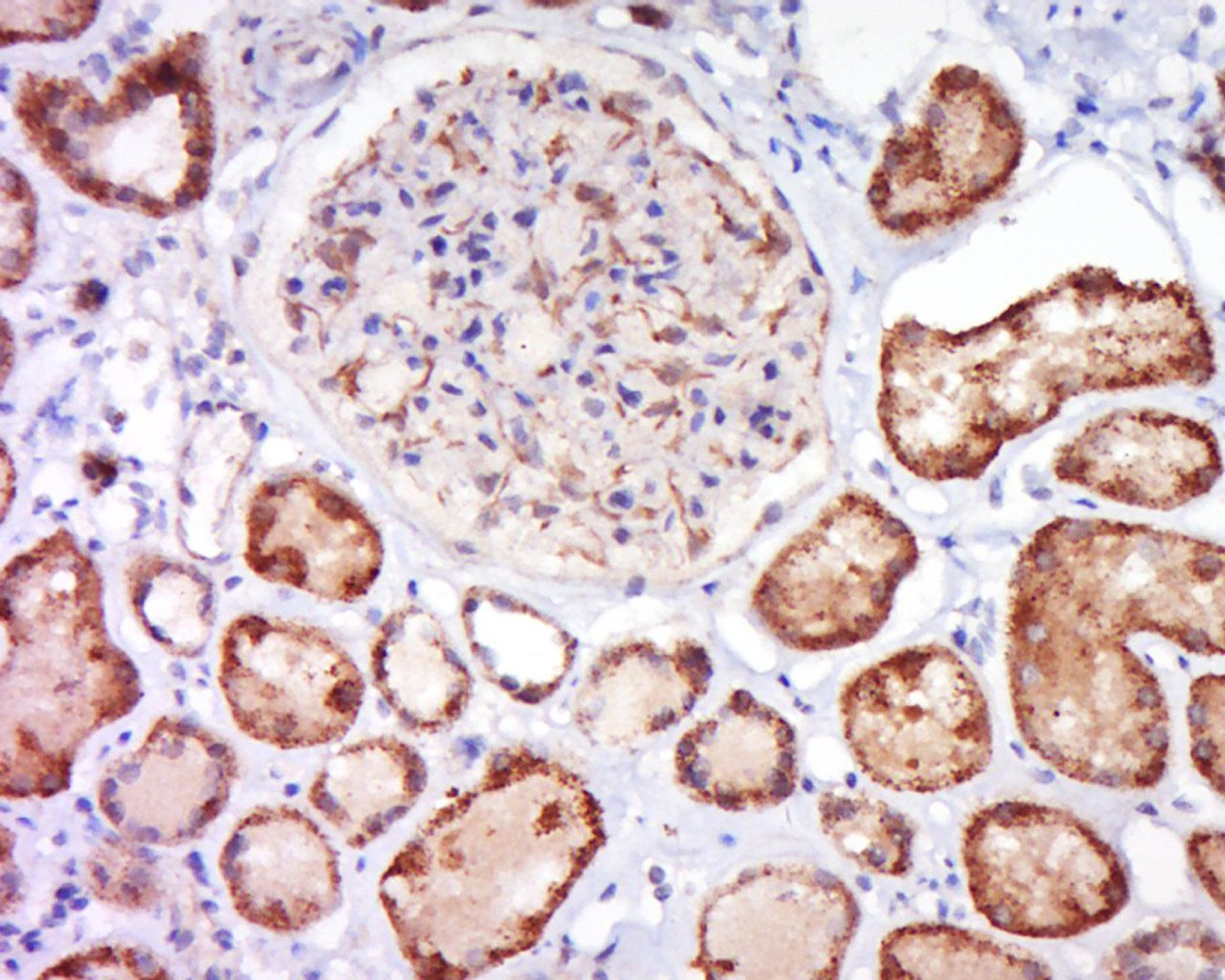 ALPPL2 Rabbit pAb(bs-20188R)-5
